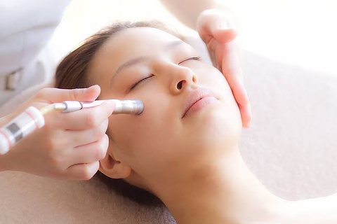 ダイヤモンド施術